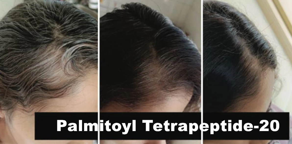 Palmitoyl Tetrapeptide-20 effects